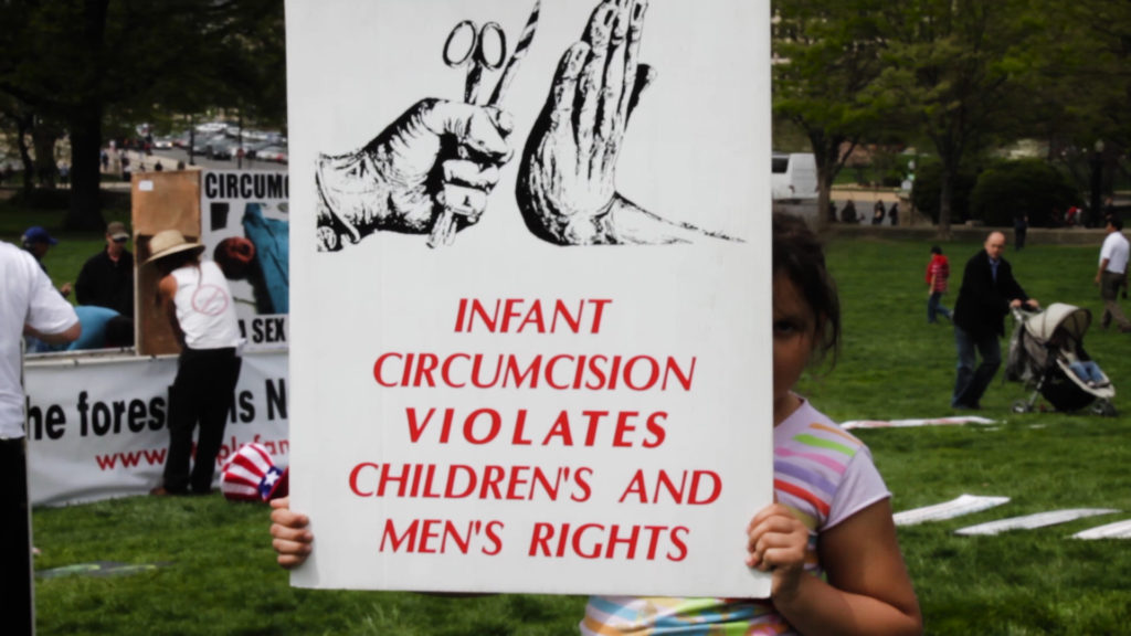 Circumcision Healing. Male infant circumcision is a violation of human rights.